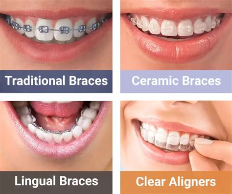 whats the metal bracket around peoples face|A Guide to the Different Types of Metal Braces .